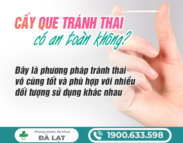 Hình ảnh minh họa